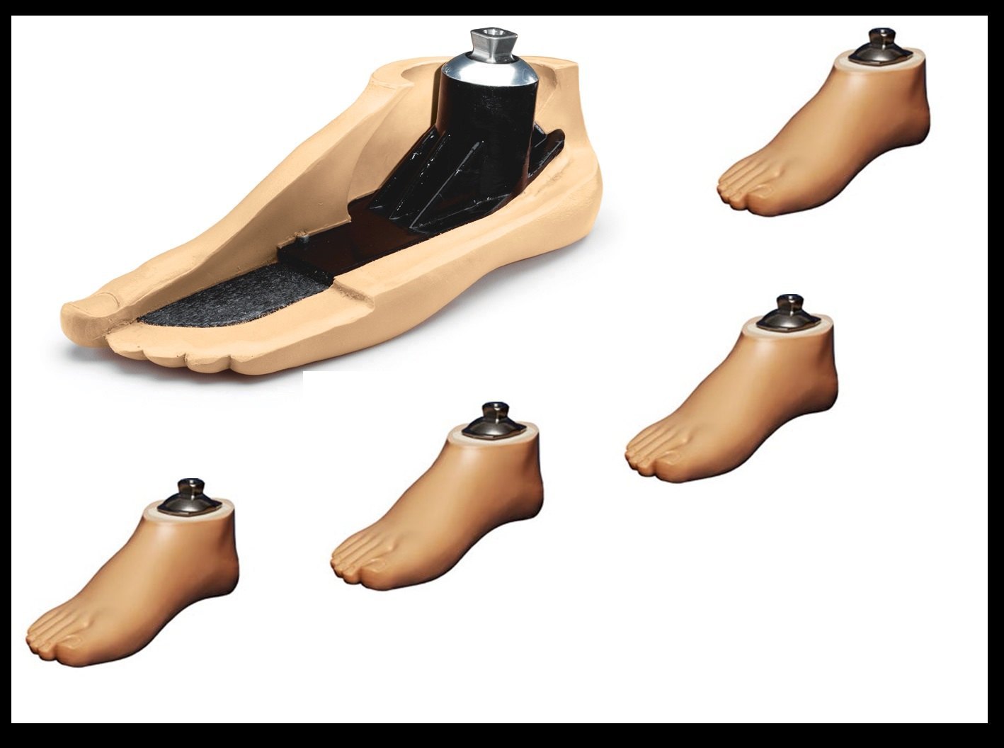 Prosthetic Feet